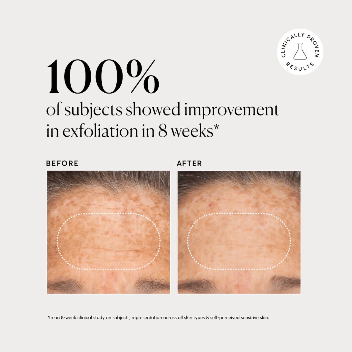 bha-liquid-exfoliant-2-k3 NATR-10027-Alt-Images-BHA-Liquid-Exfoliant-2_-03.webp